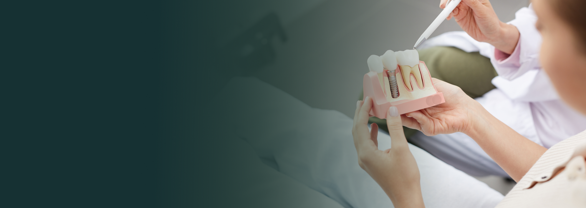 Dental Implants