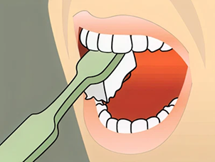 brushing Instructions