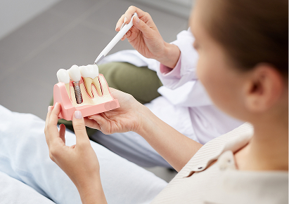 Dental Implants