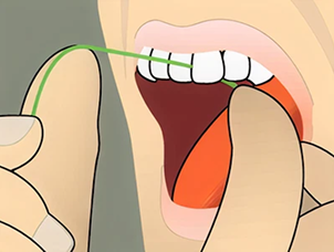 flossing instructions