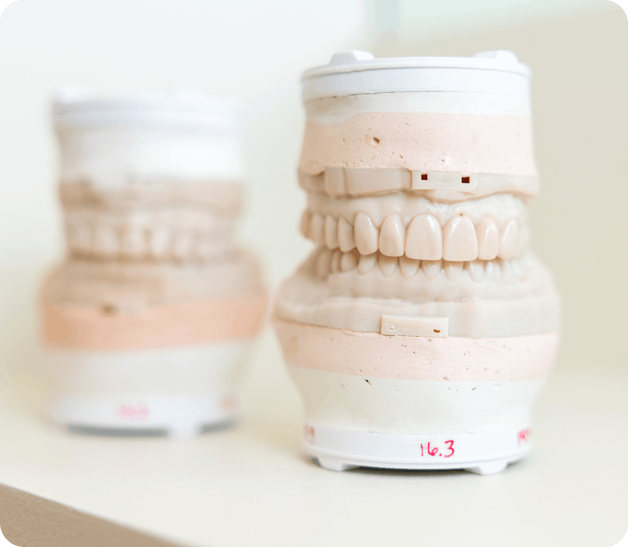 Supported Dentures