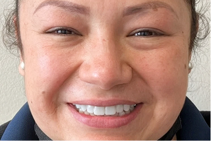 After